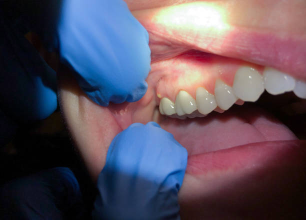 Best Dentist for Dental Trauma  in Nicoma Park, OK